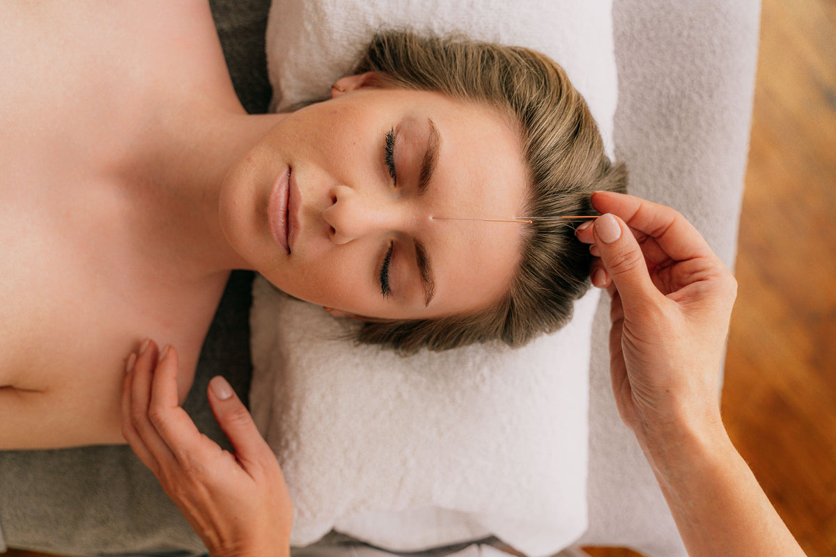 What acupuncture may support